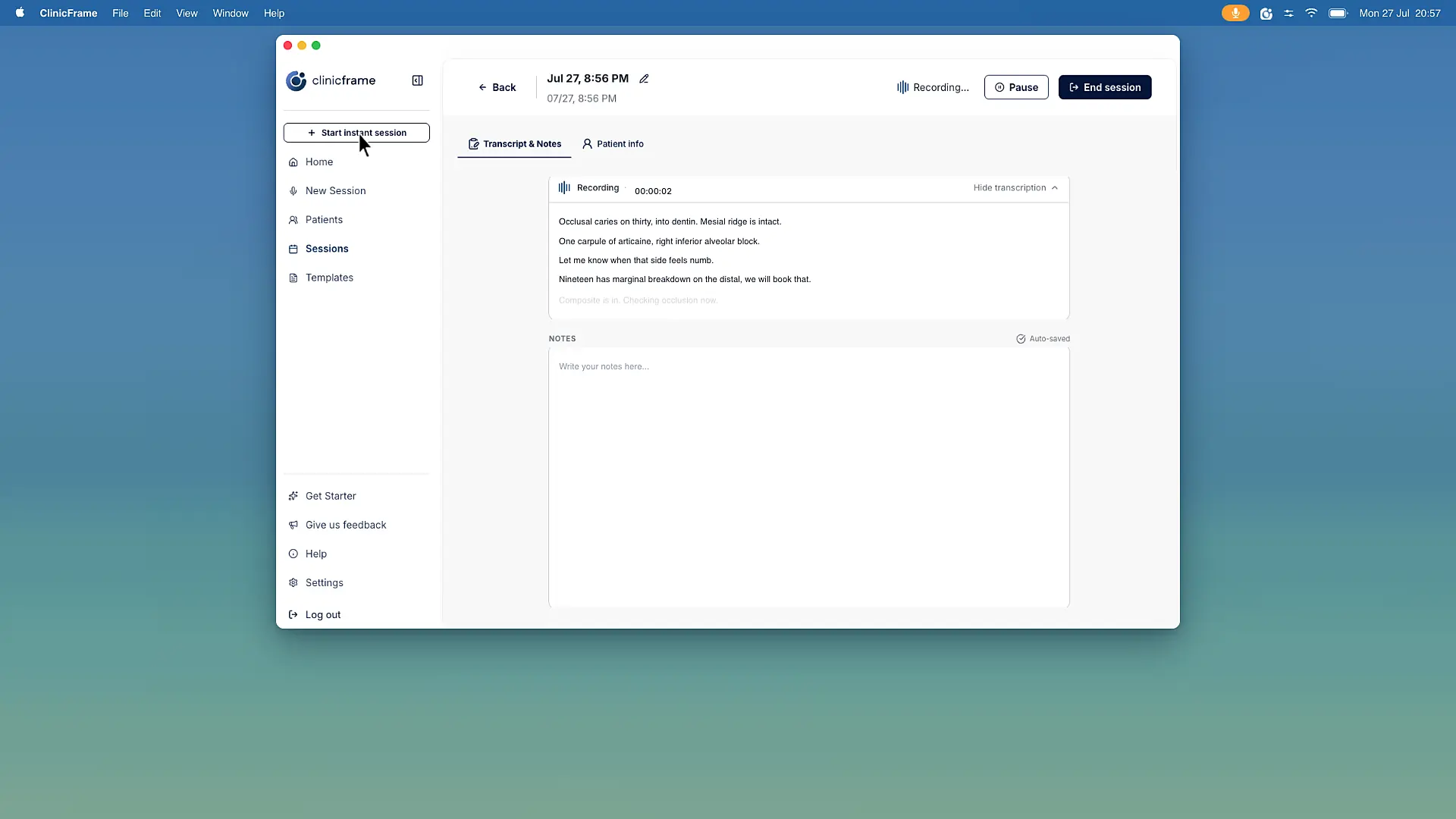 ClinicFrame product demonstration showing a dental session transcript